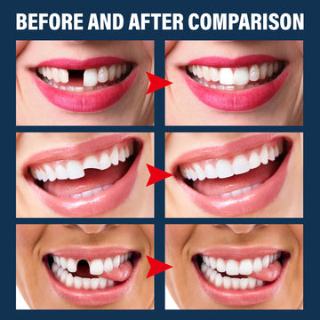 Halloween vampire fake teeth with glue set