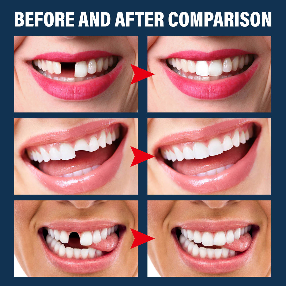 Halloween vampire fake teeth with glue set