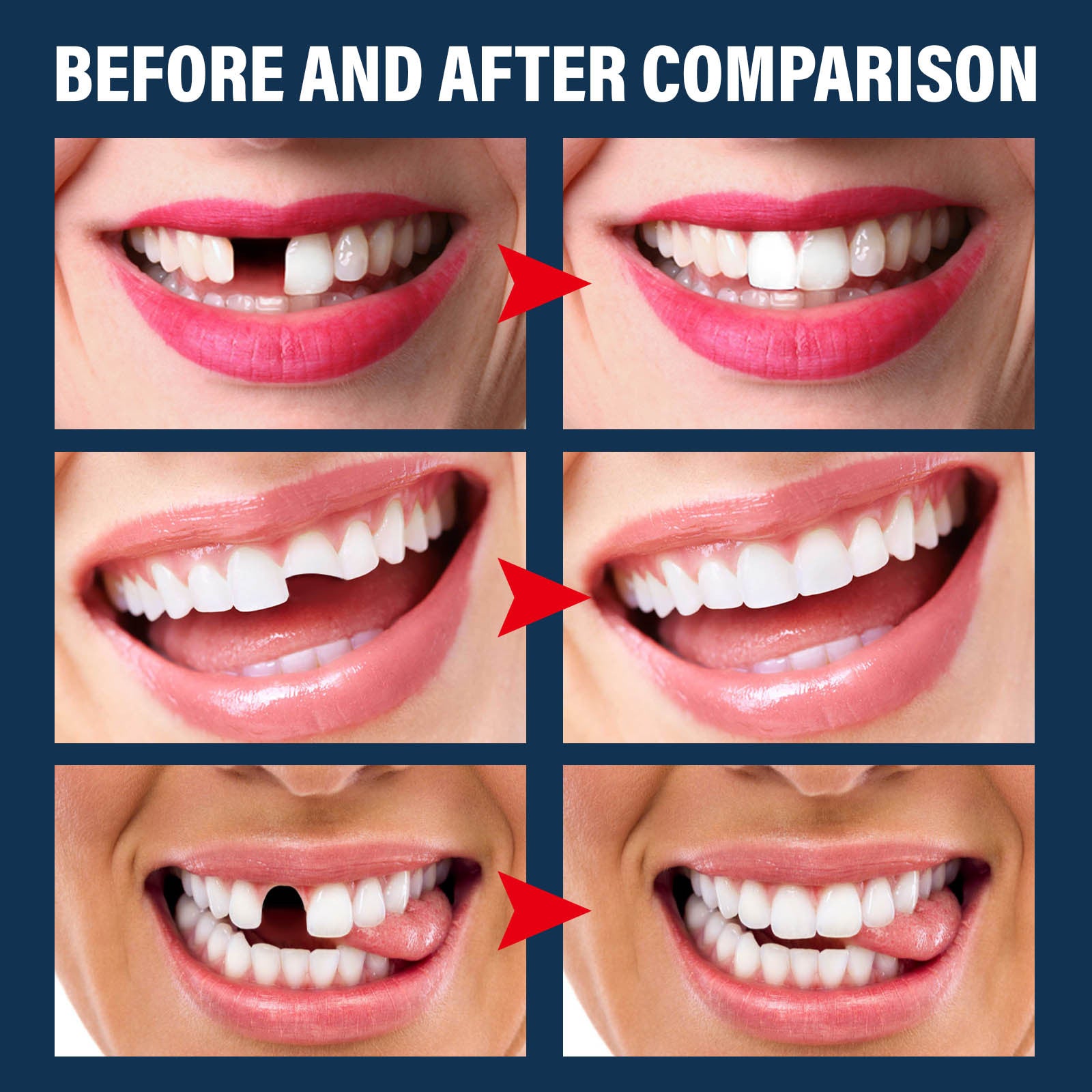 Halloween vampire fake teeth with glue set